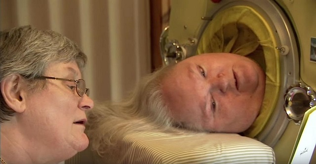 This woman has spent more than 60 years in an iron lung 
