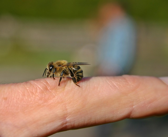 How to treat a bee sting – remedies available to anyone