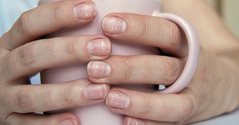 What serious diseases are signaled by white spots on the nails